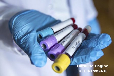 Koronavirus Ermənistanda 13 nəfəri də öldürdü