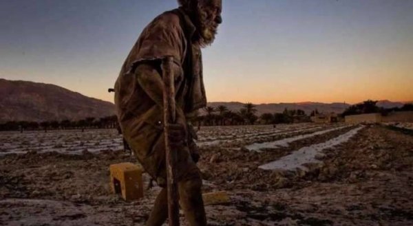 Həkimlər 67 ildir çimməyən şəxsi müayinə etdi: Nəticəyə inanmadılar - FOTO